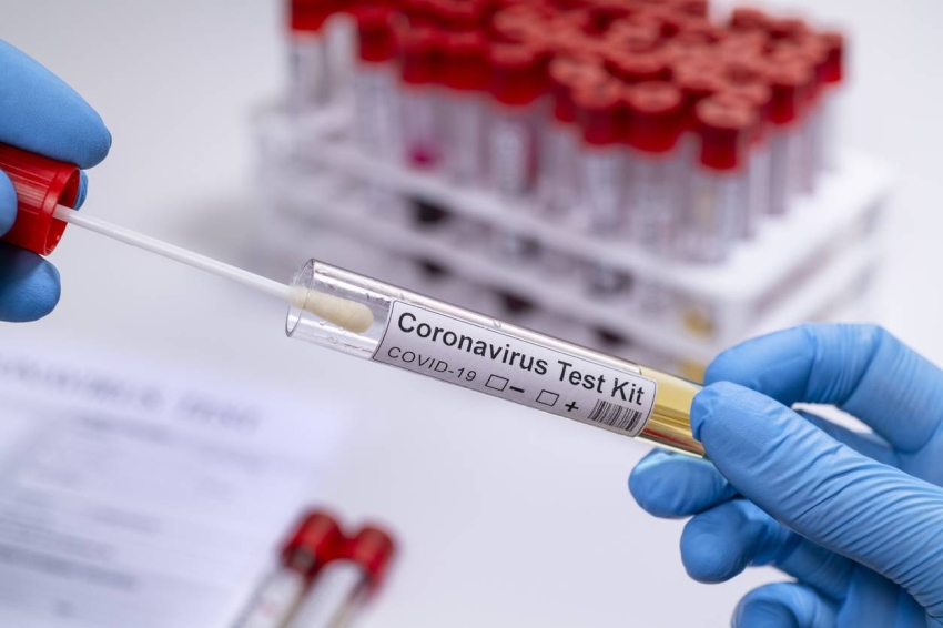 Coronavirus COVID 19 test kit novel corona virus